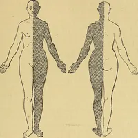 An illustration from Leçons cliniques sur l'hystérie et l'hypnotisme : faites à l'Hôpital Saint-André de Bordeaux (1891)