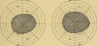 Picture 44 of 85 from Leçons cliniques sur l'hystérie et l'hypnotisme : faites à l'Hôpital Saint-André de Bordeaux (1891), leaf 356