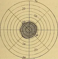 Picture 46 of 85 from Leçons cliniques sur l'hystérie et l'hypnotisme : faites à l'Hôpital Saint-André de Bordeaux (1891), leaf 368