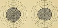 Picture 51 of 85 from Leçons cliniques sur l'hystérie et l'hypnotisme : faites à l'Hôpital Saint-André de Bordeaux (1891), leaf 437