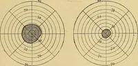 Picture 53 of 85 from Leçons cliniques sur l'hystérie et l'hypnotisme : faites à l'Hôpital Saint-André de Bordeaux (1891), leaf 440