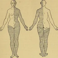Picture 61 of 85 from Leçons cliniques sur l'hystérie et l'hypnotisme : faites à l'Hôpital Saint-André de Bordeaux (1891), leaf 454