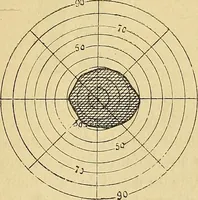 Picture 64 of 85 from Leçons cliniques sur l'hystérie et l'hypnotisme : faites à l'Hôpital Saint-André de Bordeaux (1891), leaf 468