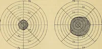Picture 71 of 85 from Leçons cliniques sur l'hystérie et l'hypnotisme : faites à l'Hôpital Saint-André de Bordeaux (1891), leaf 501