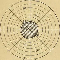 Picture 74 of 85 from Leçons cliniques sur l'hystérie et l'hypnotisme : faites à l'Hôpital Saint-André de Bordeaux (1891), leaf 508