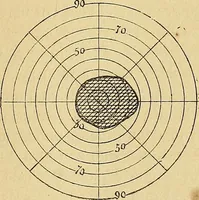 An illustration from Leçons cliniques sur l'hystérie et l'hypnotisme : faites à l'Hôpital Saint-André de Bordeaux (1891)