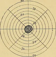 Picture 76 of 85 from Leçons cliniques sur l'hystérie et l'hypnotisme : faites à l'Hôpital Saint-André de Bordeaux (1891), leaf 513
