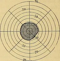 An illustration from Leçons cliniques sur l'hystérie et l'hypnotisme : faites à l'Hôpital Saint-André de Bordeaux (1891)