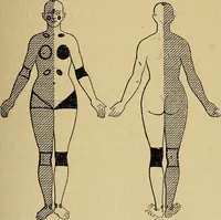Picture 19 of 83 from Leçons cliniques sur l'hystérie et l'hypnotisme : faites à l'Hôpital Saint-André de Bordeaux (1891), leaf 116