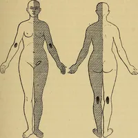 Picture 20 of 83 from Leçons cliniques sur l'hystérie et l'hypnotisme : faites à l'Hôpital Saint-André de Bordeaux (1891), leaf 118