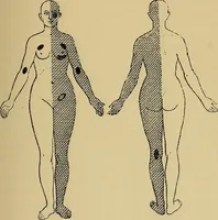 Picture 21 of 83 from Leçons cliniques sur l'hystérie et l'hypnotisme : faites à l'Hôpital Saint-André de Bordeaux (1891), leaf 120