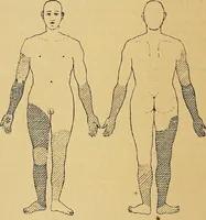 Picture 1 of 83 from Leçons cliniques sur l'hystérie et l'hypnotisme : faites à l'Hôpital Saint-André de Bordeaux (1891), leaf 13