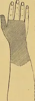 An illustration from Leçons cliniques sur l'hystérie et l'hypnotisme : faites à l'Hôpital Saint-André de Bordeaux (1891)