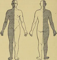 Picture 30 of 83 from Leçons cliniques sur l'hystérie et l'hypnotisme : faites à l'Hôpital Saint-André de Bordeaux (1891), leaf 279