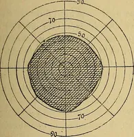 Picture 35 of 83 from Leçons cliniques sur l'hystérie et l'hypnotisme : faites à l'Hôpital Saint-André de Bordeaux (1891), leaf 332