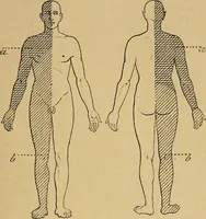 Picture 8 of 83 from Leçons cliniques sur l'hystérie et l'hypnotisme : faites à l'Hôpital Saint-André de Bordeaux (1891), leaf 34