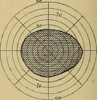 Picture 40 of 83 from Leçons cliniques sur l'hystérie et l'hypnotisme : faites à l'Hôpital Saint-André de Bordeaux (1891), leaf 359
