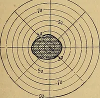 Picture 14 of 83 from Leçons cliniques sur l'hystérie et l'hypnotisme : faites à l'Hôpital Saint-André de Bordeaux (1891), leaf 38