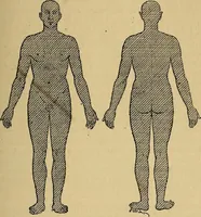 Picture 49 of 83 from Leçons cliniques sur l'hystérie et l'hypnotisme : faites à l'Hôpital Saint-André de Bordeaux (1891), leaf 380