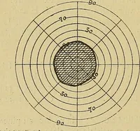 Picture 53 of 83 from Leçons cliniques sur l'hystérie et l'hypnotisme : faites à l'Hôpital Saint-André de Bordeaux (1891), leaf 417