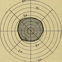 Picture 54 of 83 from Leçons cliniques sur l'hystérie et l'hypnotisme : faites à l'Hôpital Saint-André de Bordeaux (1891), leaf 417
