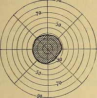 Picture 55 of 83 from Leçons cliniques sur l'hystérie et l'hypnotisme : faites à l'Hôpital Saint-André de Bordeaux (1891), leaf 432