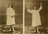 Picture 66 of 83 from Leçons cliniques sur l'hystérie et l'hypnotisme : faites à l'Hôpital Saint-André de Bordeaux (1891), leaf 526