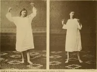 Picture 67 of 83 from Leçons cliniques sur l'hystérie et l'hypnotisme : faites à l'Hôpital Saint-André de Bordeaux (1891), leaf 526