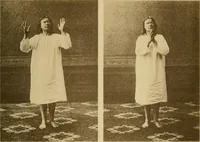 Picture 68 of 83 from Leçons cliniques sur l'hystérie et l'hypnotisme : faites à l'Hôpital Saint-André de Bordeaux (1891), leaf 528