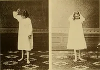 Picture 70 of 83 from Leçons cliniques sur l'hystérie et l'hypnotisme : faites à l'Hôpital Saint-André de Bordeaux (1891), leaf 530