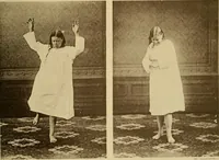 Picture 71 of 83 from Leçons cliniques sur l'hystérie et l'hypnotisme : faites à l'Hôpital Saint-André de Bordeaux (1891), leaf 530