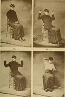 Picture 72 of 83 from Leçons cliniques sur l'hystérie et l'hypnotisme : faites à l'Hôpital Saint-André de Bordeaux (1891), leaf 532