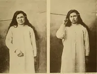 Picture 75 of 83 from Leçons cliniques sur l'hystérie et l'hypnotisme : faites à l'Hôpital Saint-André de Bordeaux (1891), leaf 536
