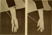 Picture 80 of 83 from Leçons cliniques sur l'hystérie et l'hypnotisme : faites à l'Hôpital Saint-André de Bordeaux (1891), leaf 540