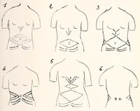 An illustration from Les Baluba (Congo Belge) (1913)