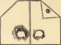 An illustration from Les maladies épidémiques de l'esprit; sorcellerie, magnétisme, morphinisme, délire des grandeurs (1887)