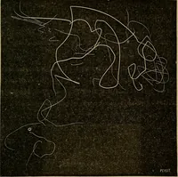 An illustration from Le somnambulisme provoqué : études physiologiques et psychologiques (1886)