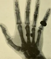 An illustration from Les rayons X et la photographie a travers les corps opaques (1896)