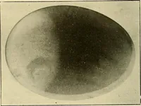 An illustration from Les rayons X et la photographie a travers les corps opaques (1896)
