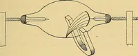 An illustration from Les rayons X et la photographie a travers les corps opaques (1896)