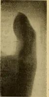 An illustration from Les rayons X et la photographie a travers les corps opaques (1896)