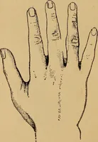 An illustration from Lessons in palmistry; studies of the eye and planetary influences (1901)
