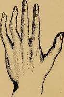 Picture 2 of 10 from Lessons in palmistry; studies of the eye and planetary influences (1901), leaf 25