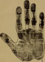 An illustration from Lessons in palmistry; studies of the eye and planetary influences (1901)