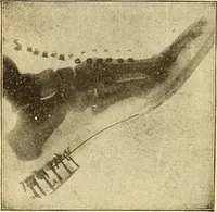 An illustration from Lessons in practical electricity; principles, experiments, and arithmetical problems, an elementary text-book (1903)