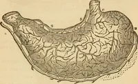 Picture 5 of 33 from Library of mesmerism and psychology (1871), leaf 314