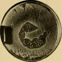 An illustration from Light energy, its physics, physiological action and therapeutic applications (1904)