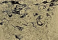An illustration from Light energy, its physics, physiological action and therapeutic applications (1904)