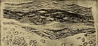 Picture 8 of 48 from Light energy, its physics, physiological action and therapeutic applications (1904), leaf 282