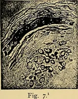 An illustration from Light energy, its physics, physiological action and therapeutic applications (1904)